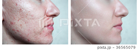 skin face.daughter 36565079