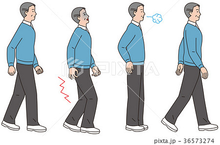 歩行中に脚に痛みが走った中年男性 歩行中に脚に痛みが走った中年男性 36573274