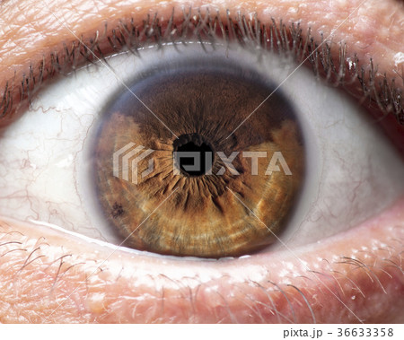 Duel Brown Iris in High Resolution 36633358