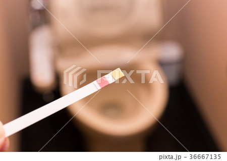 尿検査　セルフチェック 36667135