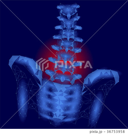 Human spine hip lumbar radiculitis pain low poly 36753958