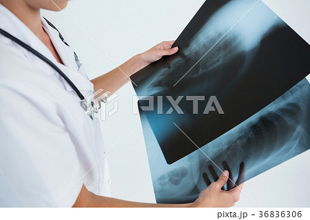 Mid section of female doctor examining X-rays 36836306