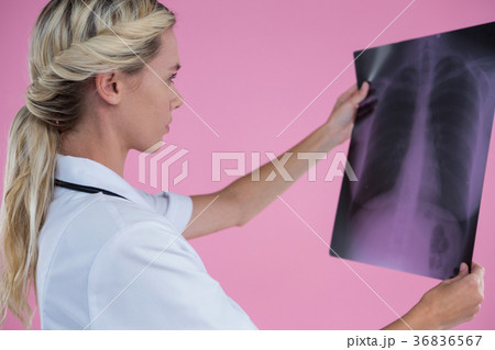 Side view of female doctor looking at X-ray Side view of female doctor looking at X-ray 36836567