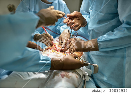 Abdominal operation process Abdominal operation process 36852935