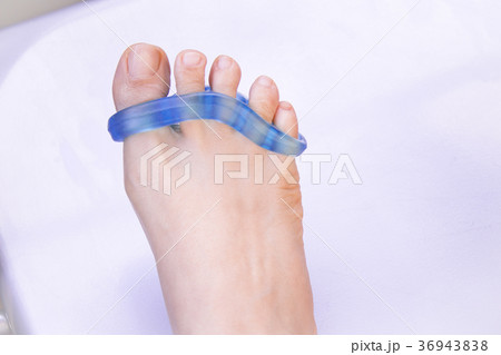 Foot of woman with silicone prosthesis Foot of woman with silicone prosthesis 36943838