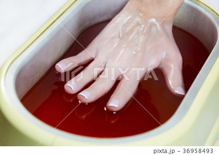 Process paraffin treatment of female hands in beau 36958493