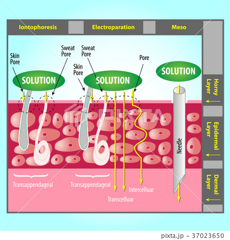 Transdermal Delivery Transdermal Delivery 37023650
