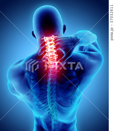 Neck painful - cervical spine, 3D illustration. Neck painful - cervical spine, 3D illustration. 37032611