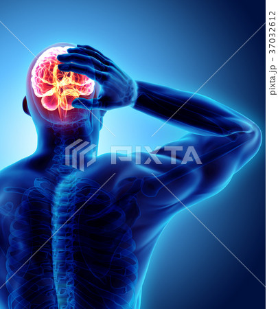3d illustration of headache human. 37032612