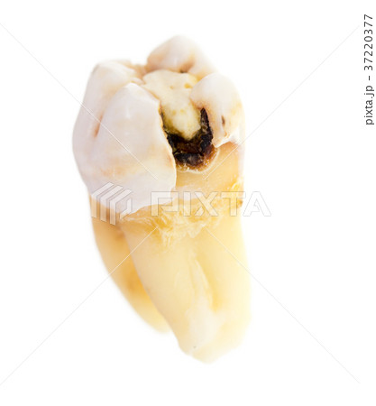 Old torn tooth on a white background 37220377