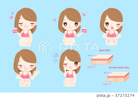 pregnant woman with stretch marks 37273274