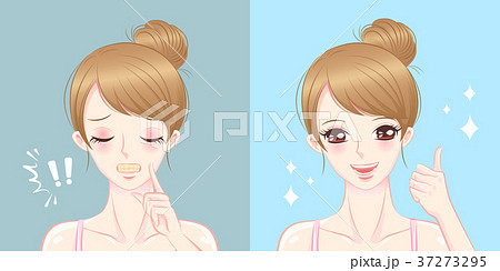woman with tooth whiten cocncept 37273295