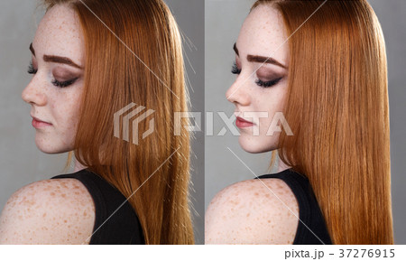 Hair before and after treatment. 37276915