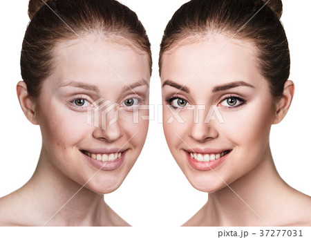 Young woman without and with makeup 37277031