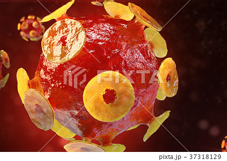 Viral hepatitis infection causing chronic liver 37318129