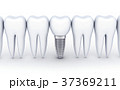 Dental row and one implant 37369211