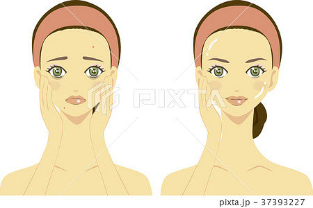 スキンケア 肌がボロボロとツルツルの女性イラストのイラスト素材