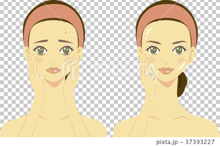 スキンケア　肌がボロボロとツルツルの女性イラスト 37393227