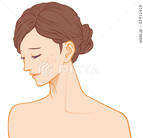 女性の横顔 困り顔 ニキビ のイラスト素材