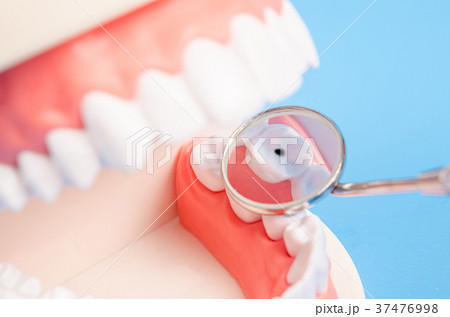 Tooth dental caries on denture. Tooth dental caries on denture. 37476998