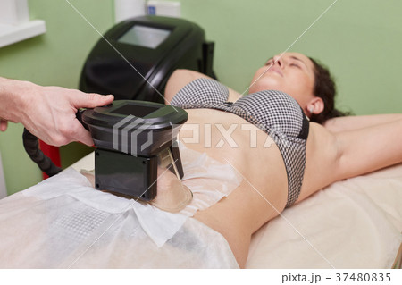 Woman getting cryolipolysis fat treatment 37480835