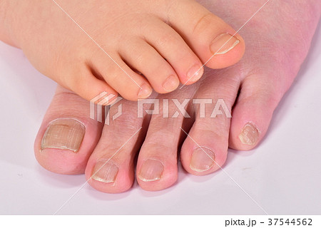 子供の足と大人の足　 37544562