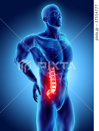 3D Illustration of sacral spine painful. 37554777