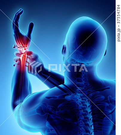 Wrist painful - skeleton x-ray. 37554784