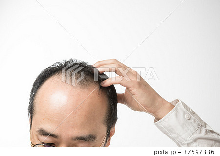 ミドル男性 薄毛 ミドル男性 薄毛 37597336