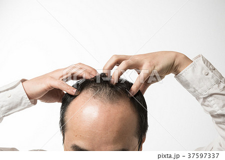 ミドル男性　薄毛 37597337