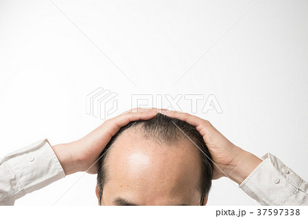 ミドル男性 薄毛 ミドル男性 薄毛 37597338