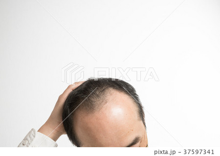 ミドル男性　薄毛 37597341