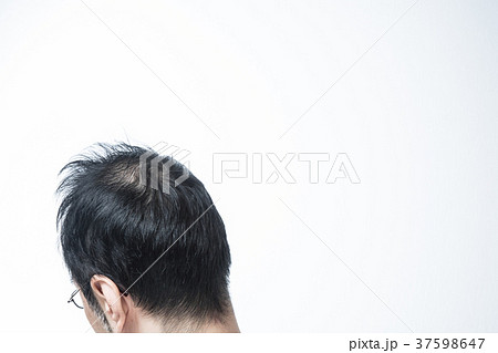 ミドル男性　薄毛 37598647