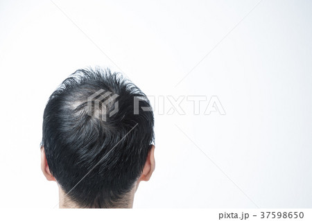 ミドル男性　薄毛 37598650