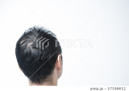 ミドル男性 薄毛 ミドル男性 薄毛 37598652