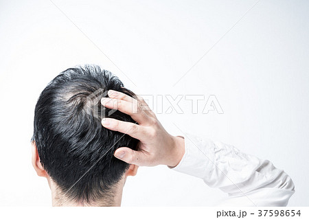 ミドル男性 薄毛 ミドル男性 薄毛 37598654