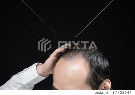 ミドル男性　薄毛 37708644