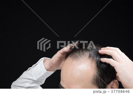 ミドル男性　薄毛 37708646