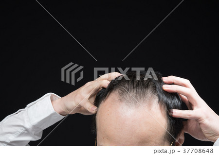 ミドル男性　薄毛 37708648