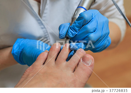 Chiropody Chiropody 37726835