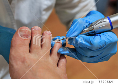 Chiropody Chiropody 37726841