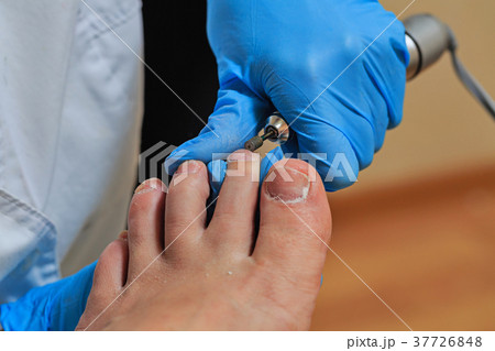 Chiropody Chiropody 37726848