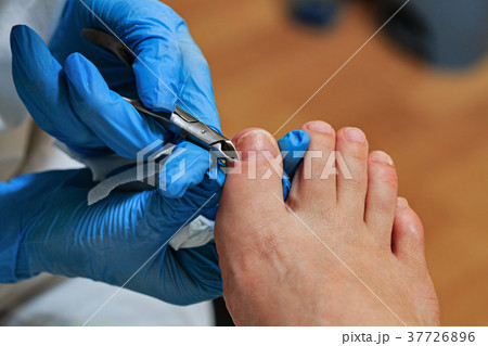 Chiropody 37726896