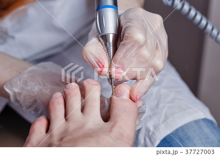 Chiropody Chiropody 37727003