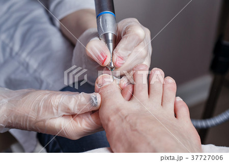 Chiropody Chiropody 37727006