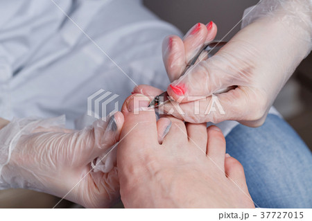 Chiropody 37727015