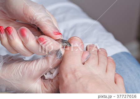 Chiropody Chiropody 37727016