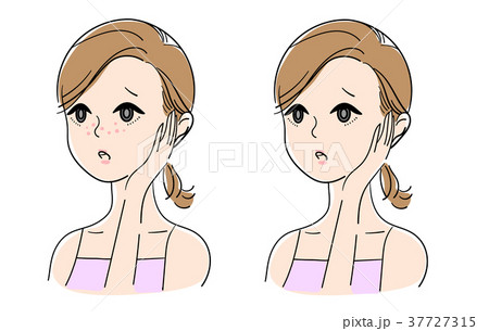 美容　女性　肌荒れ 37727315
