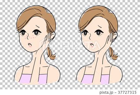 美容　女性　肌荒れ 37727315