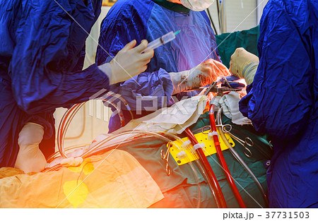 Surgeon hands are tying a knot during open heart Surgeon hands are tying a knot during open heart 37731503